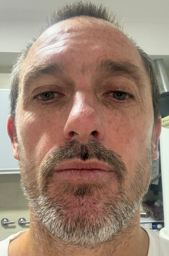 MINELLA MARTIN FEDERICO